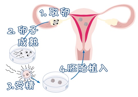 慈安中西医结合试管中心